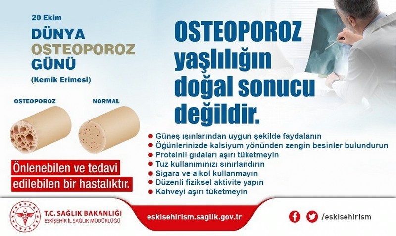 20 Eki̇m Dünya Osteoporoz Günü