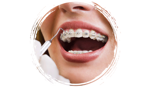 Konya Dentova Diş Kliniği Hizmeti