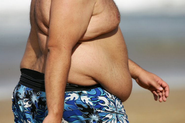 Türkiye’nin yüzde 56’sı obez!